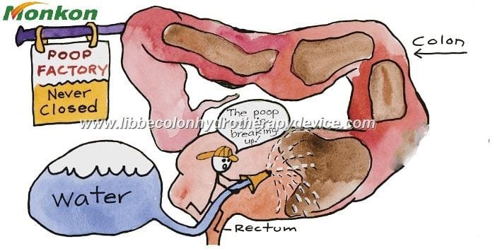 Libbe Colonic Machine