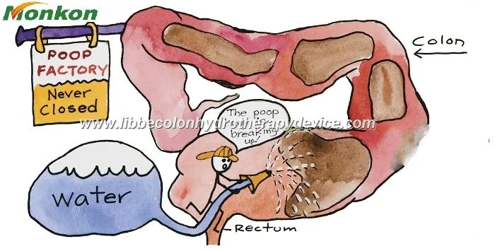 Libbe Colonic Machine
