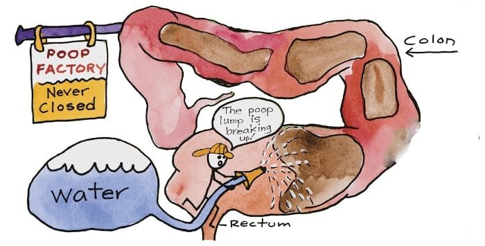 Libbe Open Colon-hydrotherapy System