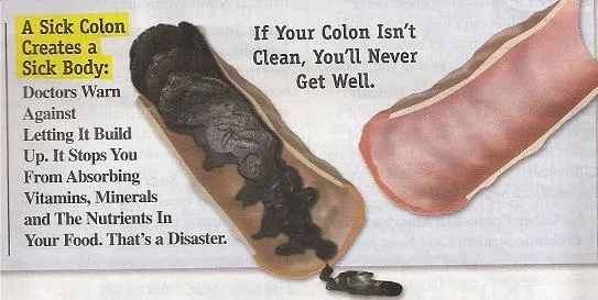 How to Naturally Clean Your Bowels? 1 Colonic Machine 379