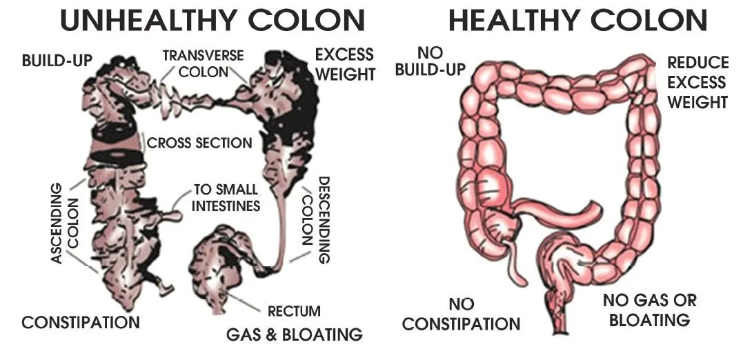 Colonic Machine 380