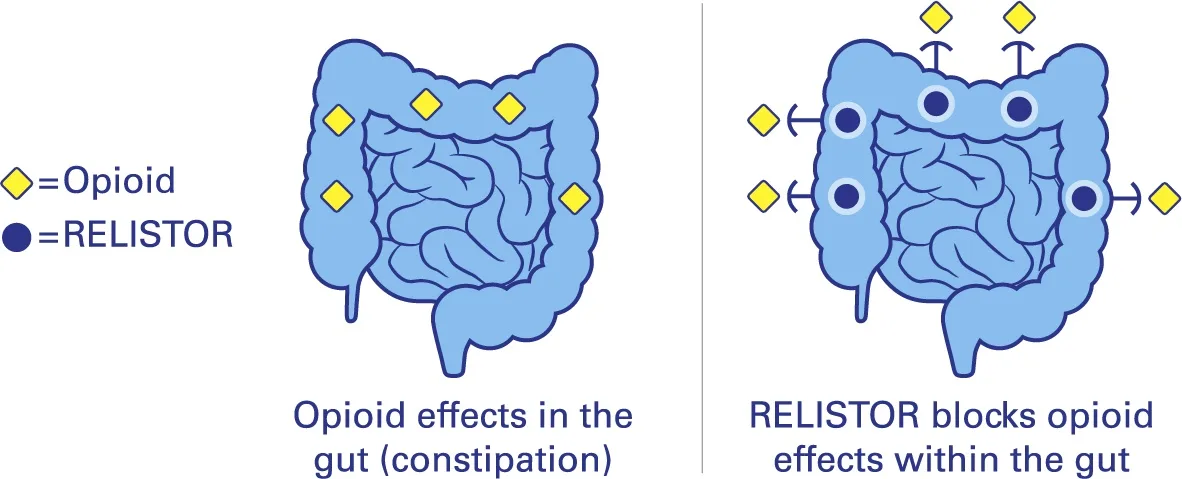 What to expect after a colonic?