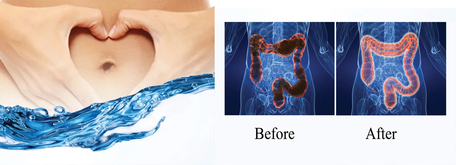 What is the best gut cleanse?