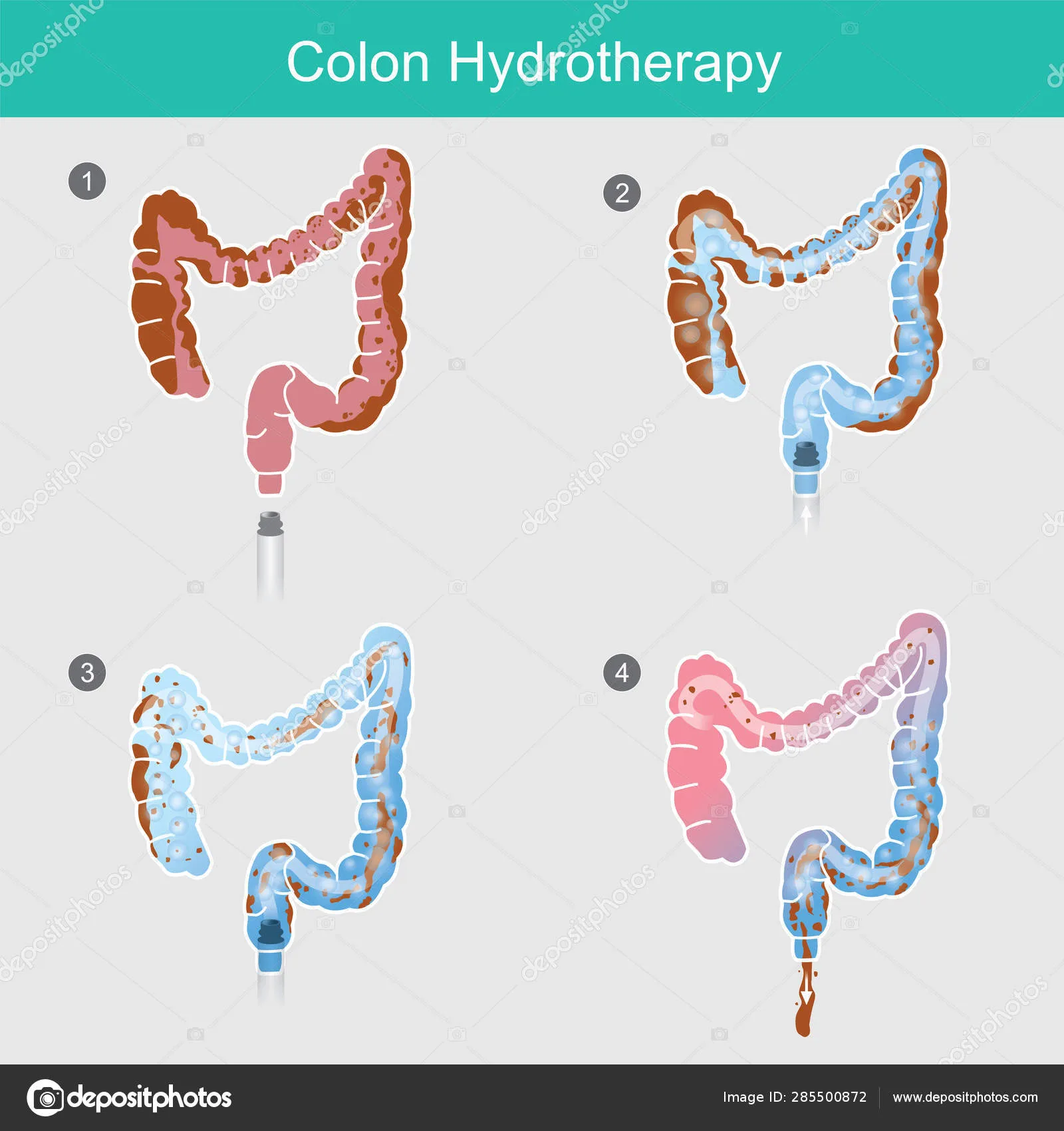 How often should you get colon hydrotherapy?