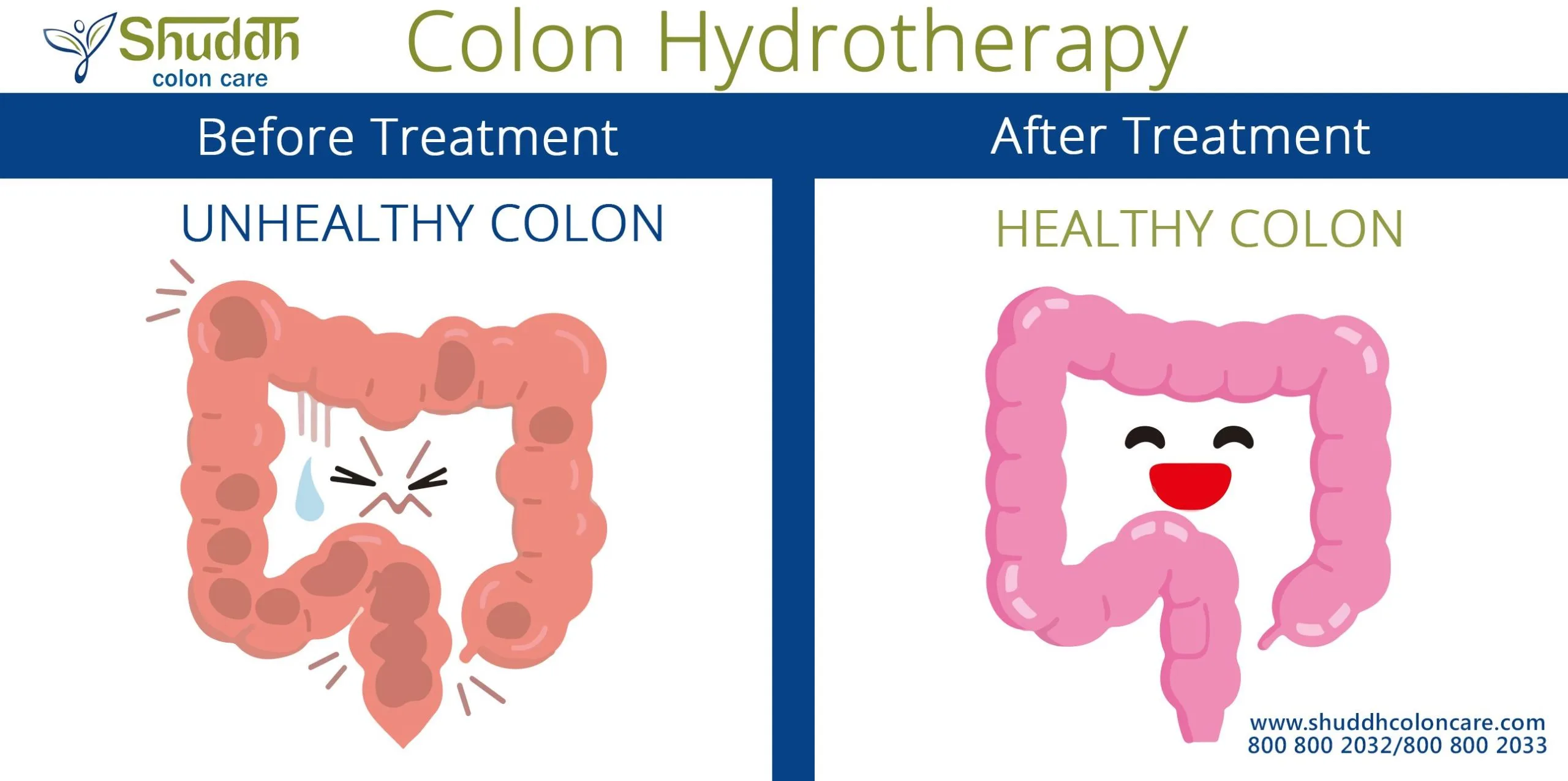 Libbe Colon Hydrotherapy 126 scaled