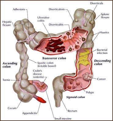 Was ist Colon-Hydro-Therapie?